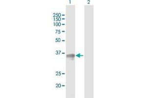 Western Blot analysis of SGCG expression in transfected 293T cell line by SGCG MaxPab polyclonal antibody. (SGCG 抗体  (AA 1-291))