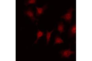 ABIN6267688 staining Hela by IF/ICC. (DOK1 抗体  (pTyr398))
