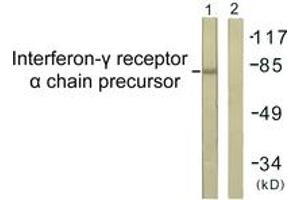 Western blot analysis of extracts from COS7 cells, using Interferon-gamma Receptor alpha chain (Ab-457) Antibody. (IFNGR1 抗体  (AA 431-480))