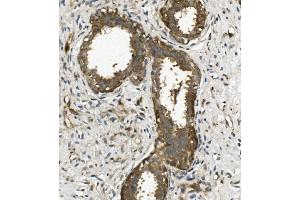 IHC analysis of Arp2/ACTR2 using anti-Arp2/ACTR2 antibody (ABIN7599349).