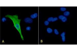 Immunofluorescence staining of HEK293 cells with Anti-Protein C (ABIN7487753) HPC-4 Immunofluorescence analysis of paraformaldehyde fixed HEK293 cells transfected with Protein C expressing plasmid (A) and non-transfected HEK293 cells (B), permeabilized with 0. (Recombinant PROC 抗体)
