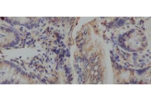 Immunohistochemistry of paraffin-embedded Mouse colon using IL10 Polyclonal Antibody at dilution of 1:50 (IL-10 抗体)