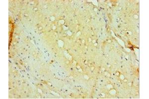 Immunohistochemistry of paraffin-embedded human small intestine tissue using ABIN7143885 at dilution of 1:100 (aHSP 抗体  (AA 1-102))
