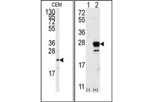 Image no. 1 for anti-GTPase NRas (NRAS) (N-Term) antibody (ABIN360038) (GTPase NRas 抗体  (N-Term))