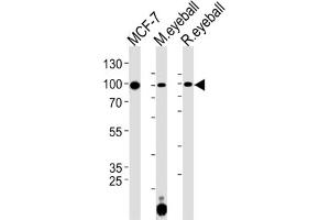 Western Blotting (WB) image for anti-Collagen, Type IX, alpha 1 (COL9A1) antibody (ABIN3001615) (COL9A1 抗体)