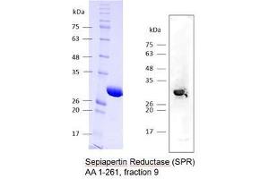 Image no. 1 for Sepiapterin Reductase (SPR) (AA 1-261) protein (Strep Tag) (ABIN3077209)
