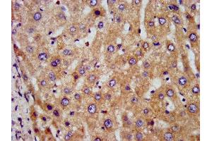 IHC image of ABIN7149912 diluted at 1:300 and staining in paraffin-embedded human liver tissue performed on a Leica BondTM system.