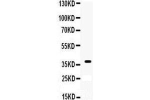 Anti-XRCC3 antibody, Western blotting All lanes: Anti XRCC3 at 0. (XRCC3 抗体  (C-Term))