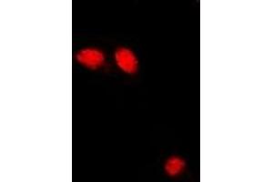 Immunofluorescent analysis of Troponin C staining in U2OS cells. (Troponin C 抗体)