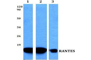 Western blot (WB) analysis of RANTES Antibody at 1/500 dilution. (CCL5 抗体)