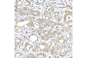Immunohistochemistry of paraffin-embedded Human liver using RMDN3 Rabbit pAb (ABIN6127274, ABIN6146979, ABIN6146981 and ABIN6221512) at dilution of 1:100 (40x lens). (RMDN3 抗体  (AA 171-470))