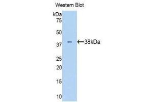 Western Blotting (WB) image for anti-Lactate Dehydrogenase B (LDHB) (AA 1-334) antibody (ABIN1174942) (LDHB 抗体  (AA 1-334))