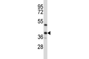 ERCC1 antibody western blot analysis in T47D lysate (ERCC1 抗体  (AA 268-297))
