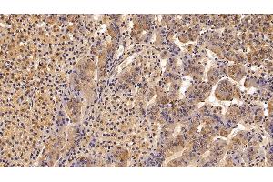 Detection of TBG in Porcine Adrenal gland Tissue using Polyclonal Antibody to Thyroxine Binding Globulin (TBG) (SERPINA7 抗体  (AA 128-415))