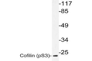 Western blot (WB) analyzes of p-Cofilin antbody in extracts from 3T3 paclitaxel cells. (Cofilin 抗体  (pSer3))