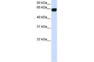 WB Suggested Anti-PIGT Antibody Titration:  0. (PIGT 抗体  (C-Term))