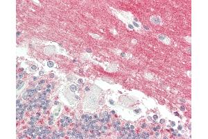 anti-Glycoprotein M6A (GPM6A) (AA 232-259) antibody