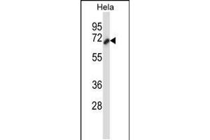 Western blot analysis in Hela cell line lysates (35ug/lane). (Cortactin 抗体  (AA 273-302))