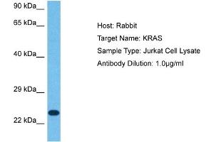 Host: Rabbit Target Name: KRAS Sample Tissue: Human Jurkat Whole Cell Antibody Dilution: 1ug/ml (K-RAS 抗体  (N-Term))