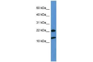 WB Suggested Anti-RPS27A  Antibody Titration: 0. (RPS27A 抗体  (Middle Region))
