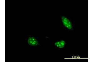 Immunofluorescence of monoclonal antibody to PIM1 on HeLa cell. (PIM1 抗体  (AA 1-100))