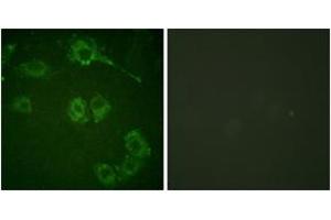 Immunofluorescence analysis of HuvEc cells, using COT (Ab-290) Antibody. (CROT 抗体  (AA 256-305))