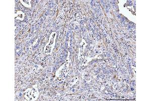 IHC analysis of MT-ND5 using anti-MT-ND5 antibody (ABIN7600145).
