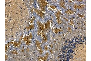 MLC1 Antibody at 1/100 staining mouse brain tissue by IHC-P. (MLC1 抗体)