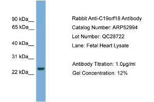 WB Suggested Anti-C19orf18  Antibody Titration: 0. (C19orf18 抗体  (N-Term))