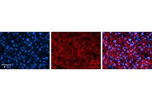 Rabbit Anti-ZNF259 Antibody   Formalin Fixed Paraffin Embedded Tissue: Human Liver Tissue Observed Staining: Nucleus and cytoplasm in hepatocytes Primary Antibody Concentration: N/A Other Working Concentrations: 1:600 Secondary Antibody: Donkey anti-Rabbit-Cy3 Secondary Antibody Concentration: 1:200 Magnification: 20X Exposure Time: 0. (ZNF259 抗体  (C-Term))
