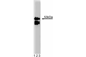 Western blot analysis of LAP2 on a RSV-3T3 cell lysate. (Thymopoietin 抗体  (AA 34-156))