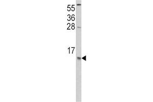 Western Blotting (WB) image for anti-Chemokine (C-C Motif) Ligand 2 (CCL2) antibody (ABIN3002757) (CCL2 抗体)
