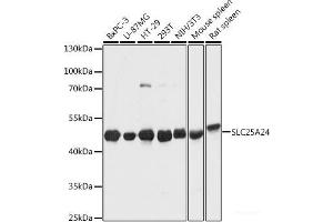 Western blot analysis of extracts of various cell lines using SLC25A24 Polyclonal Antibody at dilution of 1:1000. (SLC25A24 抗体)