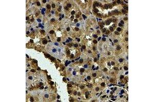 Immunohistochemical analysis of Karyopherin alpha-6 staining in human kidney formalin fixed paraffin embedded tissue section. (KPNA6 抗体)