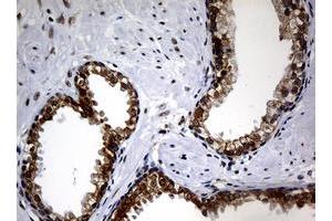 Image no. 2 for anti-Nibrin (NBN) (AA 461-754) antibody (ABIN1491539) (Nibrin 抗体  (AA 461-754))