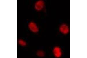 ABIN6274298 staining Hela cells by IF/ICC. (CKS1 抗体  (N-Term))