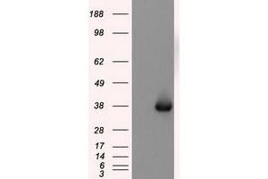 Image no. 2 for anti-Nitrilase Family, Member 2 (NIT2) antibody (ABIN1499737)