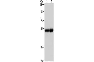Gel: 8 % SDS-PAGE, Lysate: 40 μg, Lane 1-2: Human liver cancer tissue, Human kidney tissue, Primary antibody: ABIN7191676(NOTCH4 Antibody) at dilution 1/500, Secondary antibody: Goat anti rabbit IgG at 1/8000 dilution, Exposure time: 2 minutes (NOTCH4 抗体)
