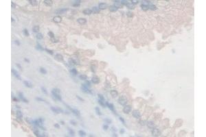 Immunohistochemistry (IHC) image for anti-Follistatin-Like 1 (FSTL1) (AA 21-308) antibody (ABIN7436609)