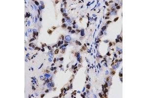 Immunohistochemistry (Paraffin-embedded Sections) (IHC (p)) image for anti-Histone 3 (H3) (H3K4me) antibody (ABIN3023251)