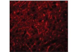 Immunofluorescence of PRDM16 in Human Brain cells with PRDM16 Antibody  at 20 µg/ml. (PRDM16 抗体  (C-Term))