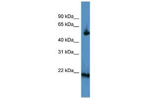 WB Suggested Anti-OPA3 Antibody Titration: 0. (OPA3 抗体  (C-Term))
