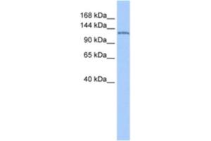 Western Blotting (WB) image for anti-Nucleoporin 155kDa (NUP155) antibody (ABIN2463616) (NUP155 抗体)