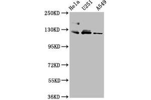 Western Blot Positive WB detected in: Hela whole cell lysate, U251 whole cell lysate, A549 whole cell lysate All lanes: FBLN2 antibody at 3. (FBLN2 抗体  (AA 301-440))