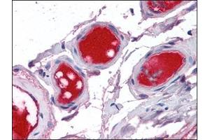 Small intestine, vessels: Formalin-Fixed, Paraffin-Embedded (FFPE) (Coagulation Factor X 抗体)