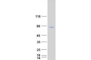 Validation with Western Blot (NF-kB p65 Protein (Transcript Variant 1) (Myc-DYKDDDDK Tag))