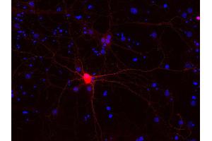 Indirect immunostaining of PFA fixed rat hippocampus neurons (dilution 1 : 500; red). (Calbindin D28k/D29k 抗体)
