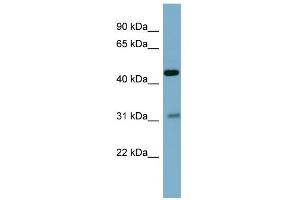 WB Suggested Anti-OMD Antibody Titration: 0. (Osteomodulin 抗体  (Middle Region))