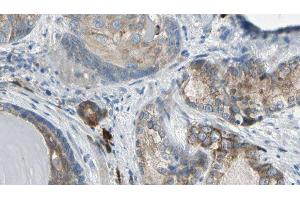 ABIN6275372 at 1/100 staining Human prostate tissue by IHC-P. (KCNK15 抗体  (C-Term))