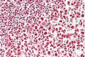 ABIN5539622 (5µg/ml) staining of paraffin embedded Human Tonsil. (c-FOS 抗体  (AA 283-295))